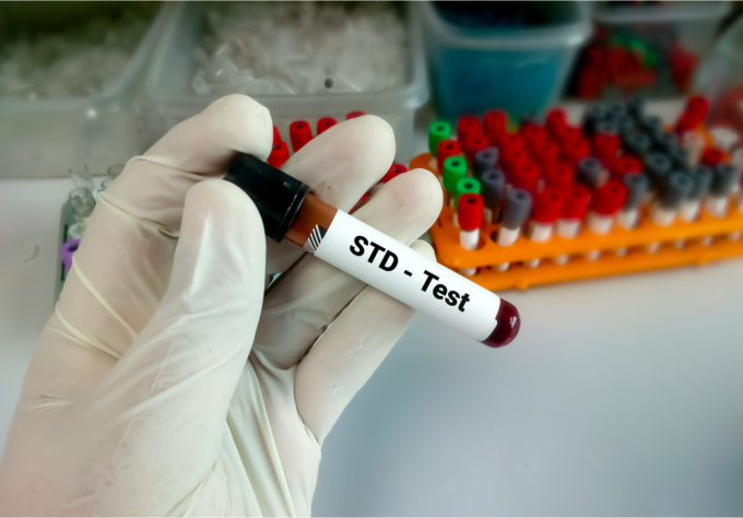 myths-and-facts-about-sexually-transmitted-diseases